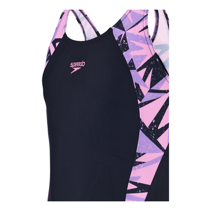 Hyperboom Splice Muscleback Navy/pink