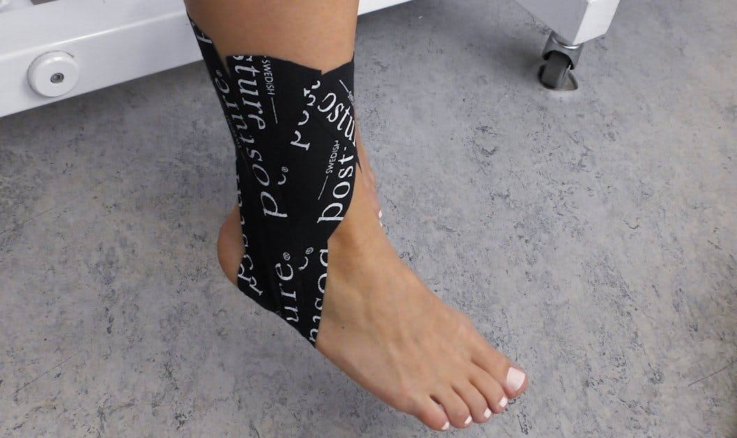 Video: Sådan taper du foden efter en forstuvning Image